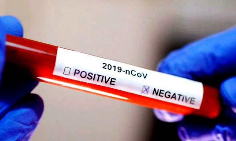 “Não podemos baixar a guarda”; Gerente do Comitê de Crise pede que população continue alerta na prevenção do coronavírus em Ituporanga
