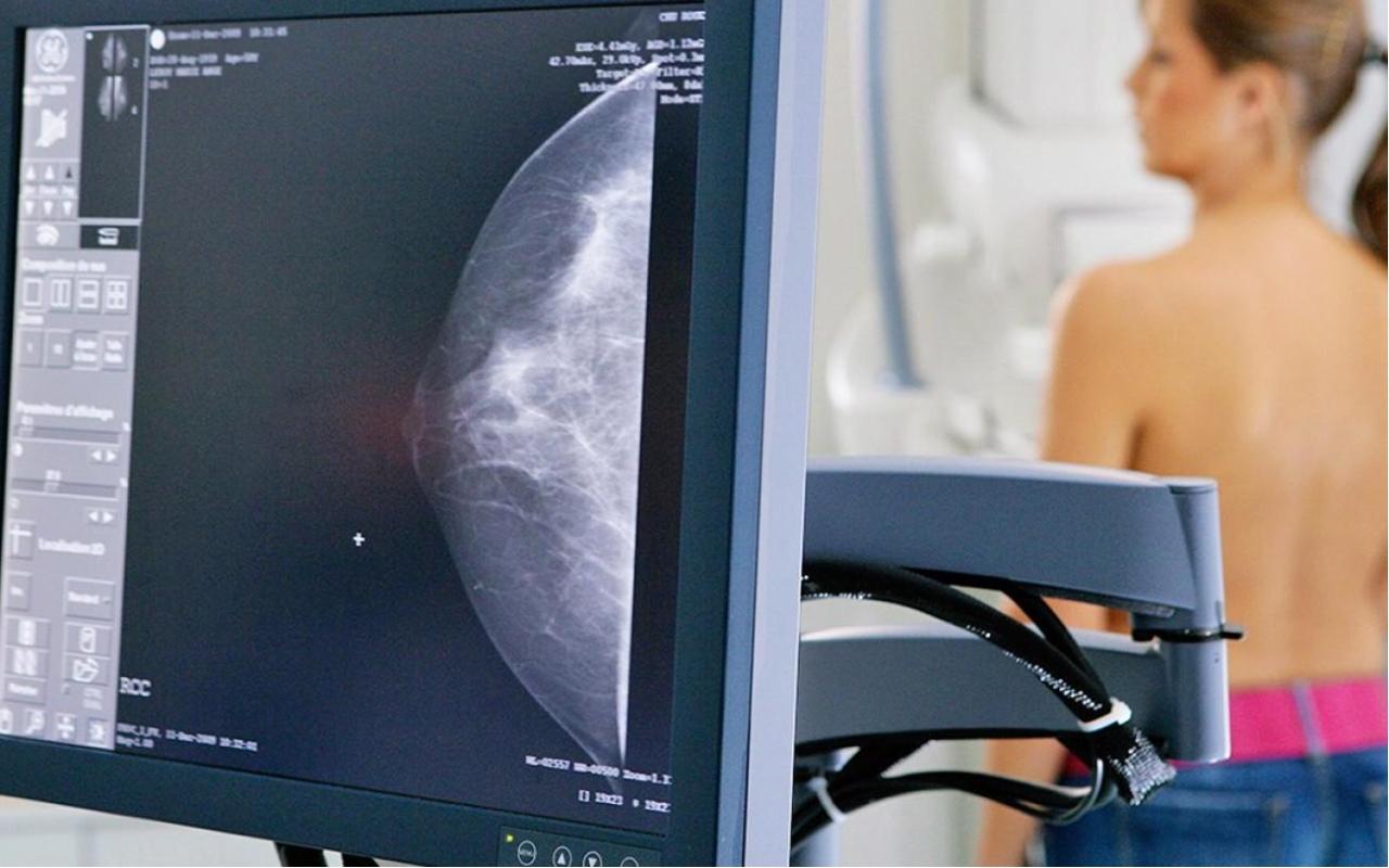 5 de fevereiro é dia da mamografia: saiba a importância do exame para prevenção do câncer de mama
