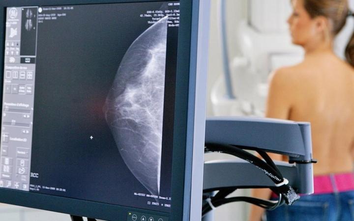 5 de fevereiro é dia da mamografia: saiba a importância do exame para prevenção do câncer de mama