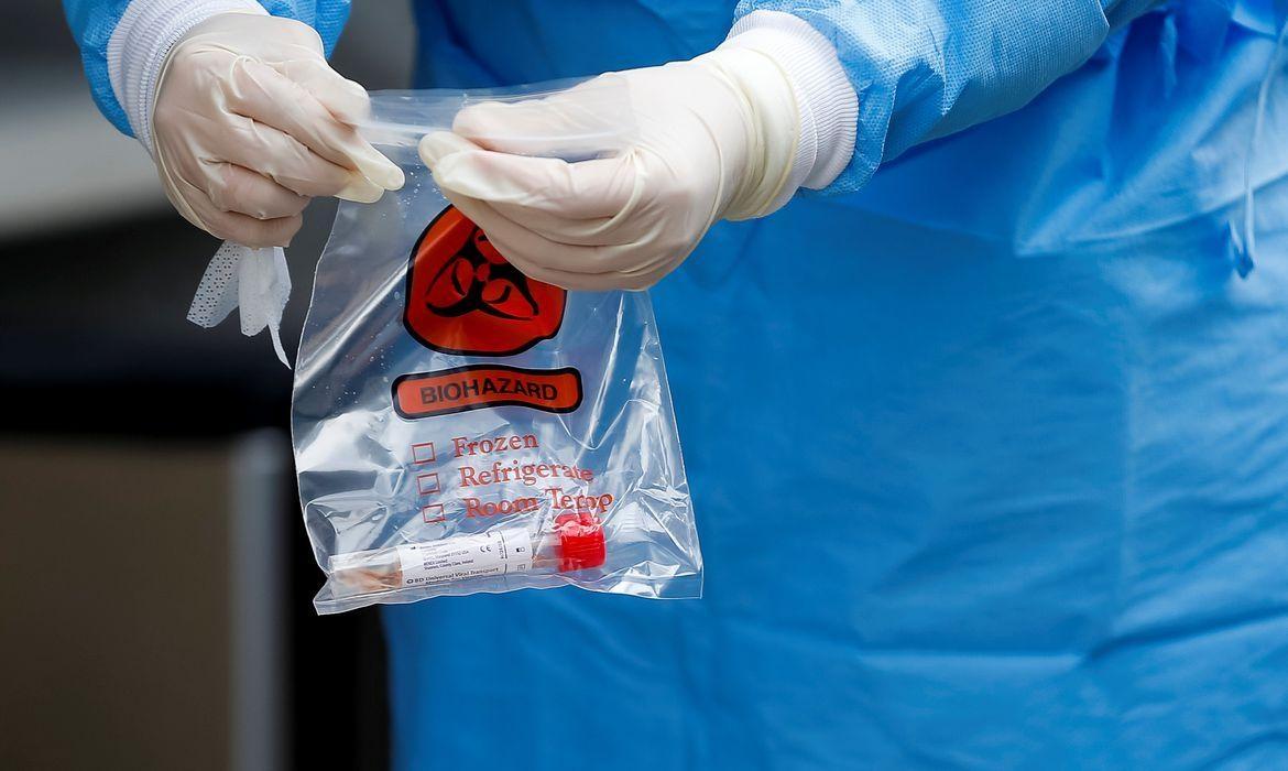 Administração de Ituporanga vai adquirir kits de testes rápidos para coronavírus