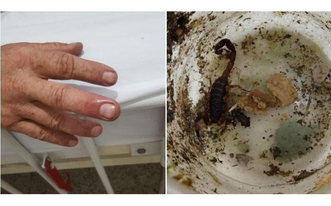 Biólogo é picado por escorpião e vai parar no hospital no Alto Vale do Itajaí