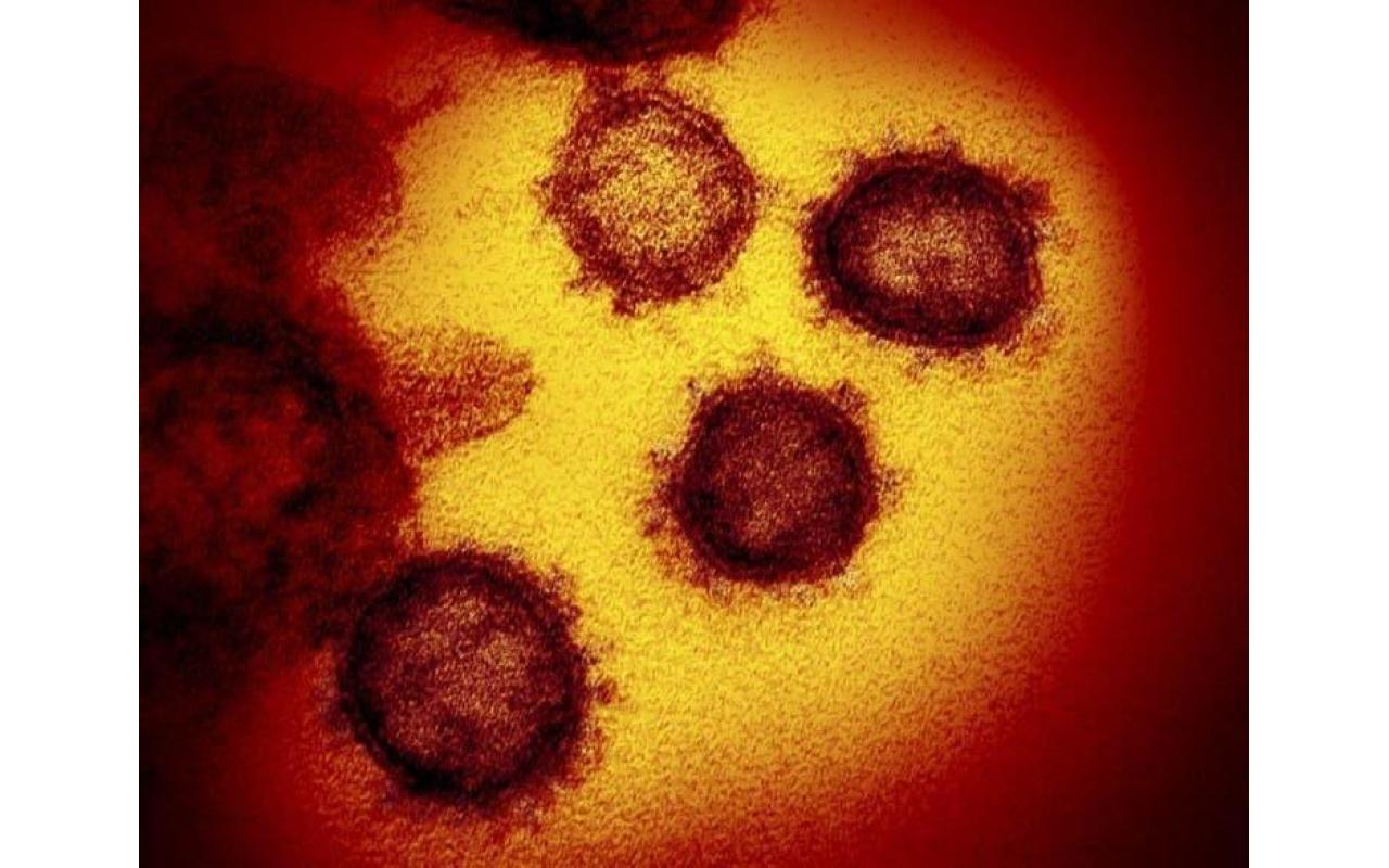 Covid-19: Após dois novos casos Ituporanga confirma transmissão comunitária do coronavírus