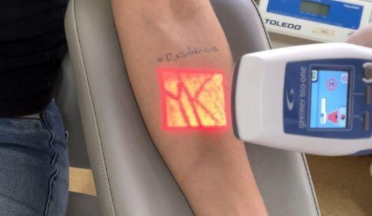 HEMOSC inova com sistema de visualização de veias para qualificar atendimento aos pacientes