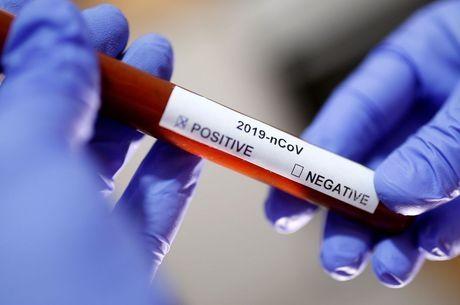 Imbuia registra primeira morte por complicações da Covid-19