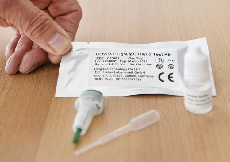 Ituporanga recebe 300 testes rápidos para coronavírus
