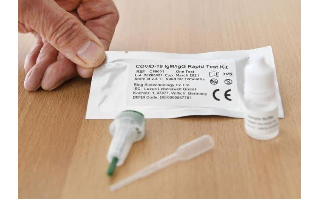 Ituporanga recebe 300 testes rápidos para coronavírus