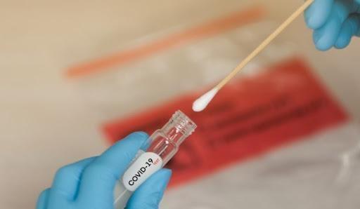 Responsável pela Vigilância Epidemiológica de Ituporanga faz apêlo para que pessoas com sintomas de Covid façam testagem