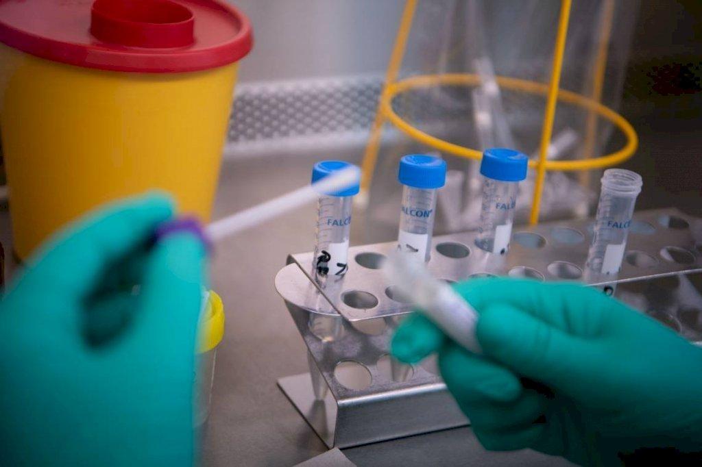 Rio do Sul ainda não recebeu dois mil testes rápidos comprados a cerca de um mês