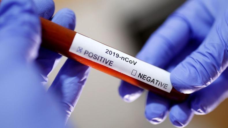 Vigilância Epidemiológica de Ituporanga solicita que população reforce cuidados para evitar aumento de casos de Covid-19 no município