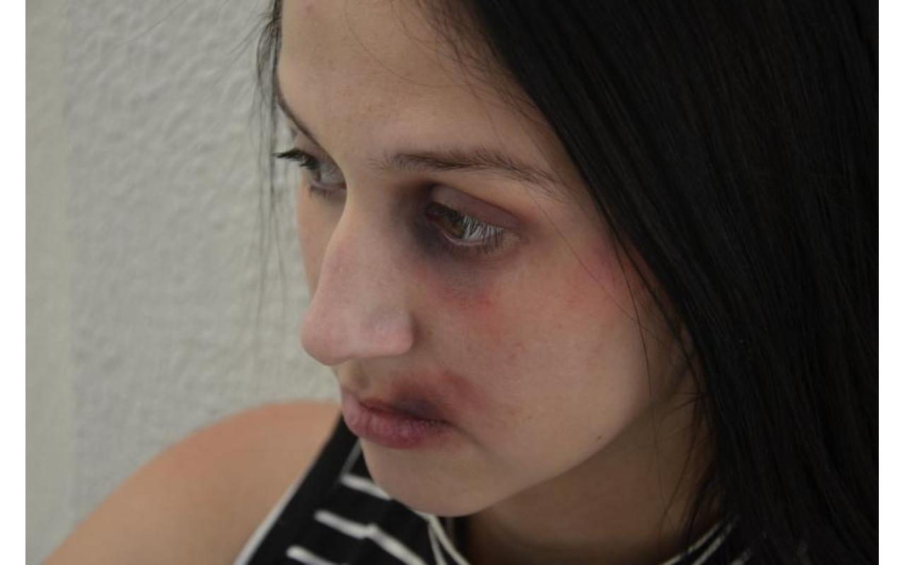 Violência contra mulher aumenta na região do Alto Vale